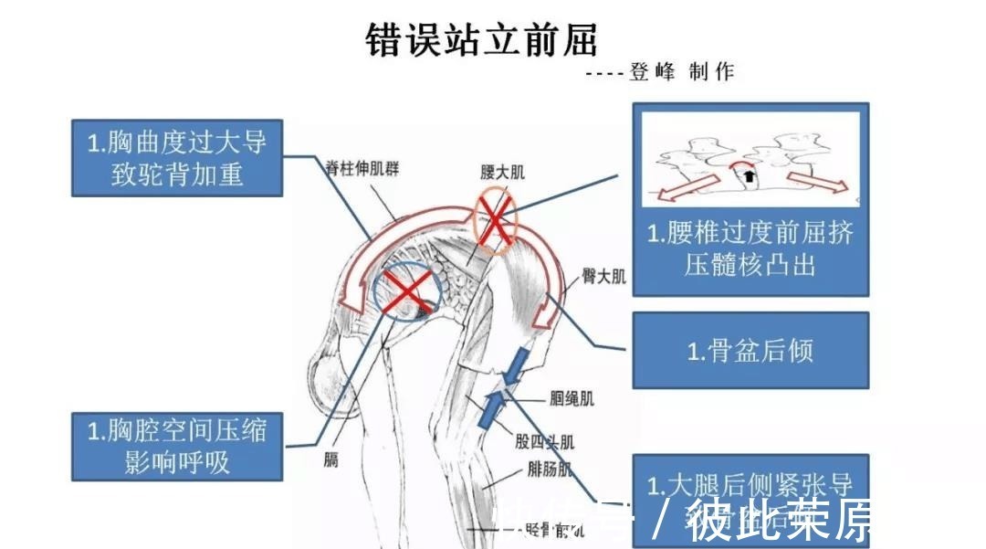 关节|瑜伽人须知的6个解剖学术语,附12个站立体式解剖图!