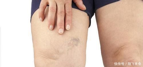 这项运动|每天睡觉前坚持“靠墙抬腿”,一个月后,四件好事兴许会不请自