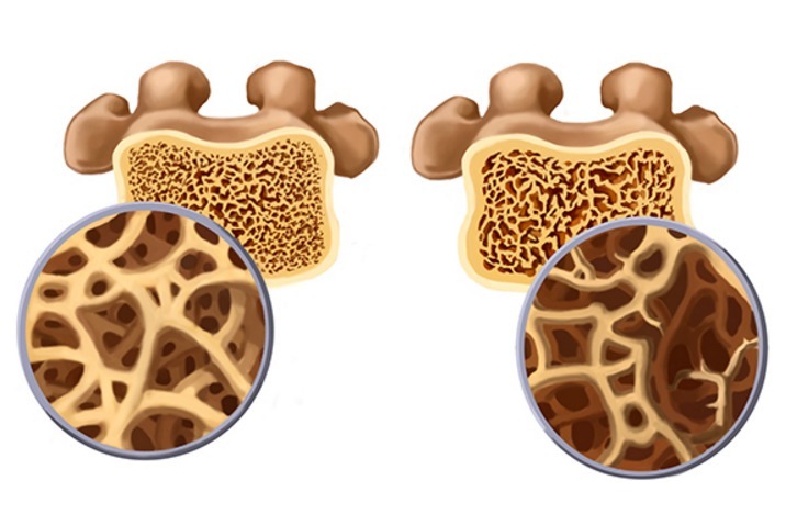 西红柿汁|一份简单的西红柿炒蛋,竟是5种疾病的“特效药”,望你早知