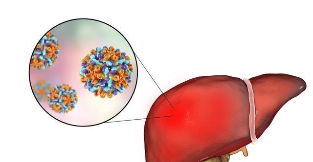 ct|肝部癌症,牙齿先知若牙齿有这3异常,建议去做CT
