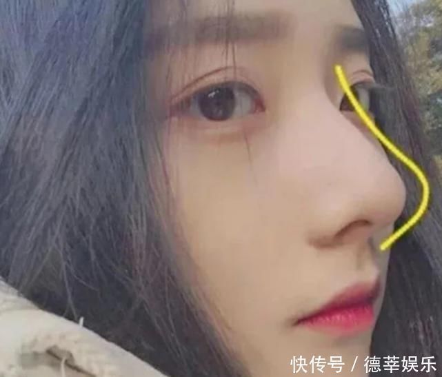 樱花脸|脸上这“3地方”凸起的女生,是标准“樱花脸”,全中异性缘爆棚