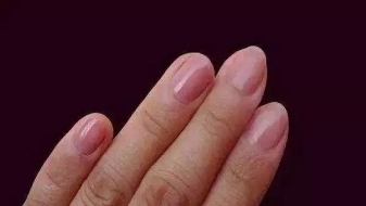 妇科疾病|没有妇科疾病的女人,手上有4个特征,你若占1个,子宫很健康