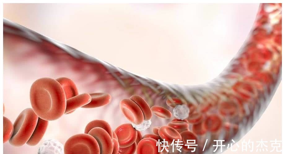 黑枸杞|高血脂的“祸首”公布,不只是喝酒吃肉,还有它,别再傻傻忽视了