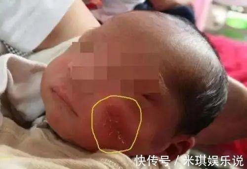 婆婆|四年前,男婴吃奶太用力,小脸被亲妈用剪刀划伤!他现状如何了?