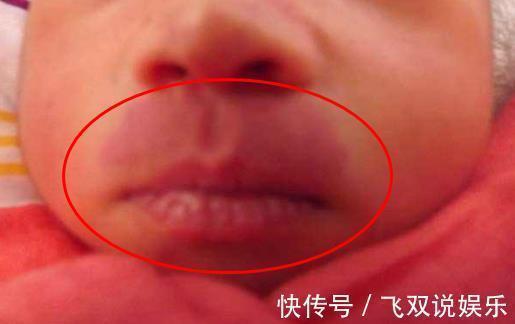 孕妈|怀孕后,几件事孕妈最好别做,容易在宝宝身上留下“胎记”!