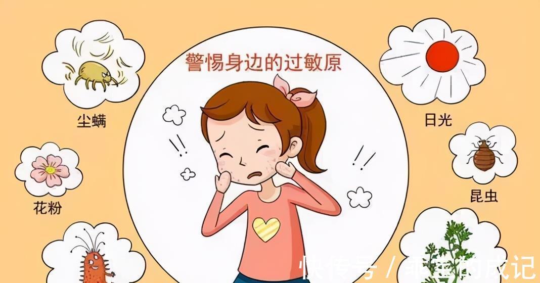 荨麻疹|贴膏药出疹子、皮肤瘙痒起风团,总是过敏,是体质弱吗?