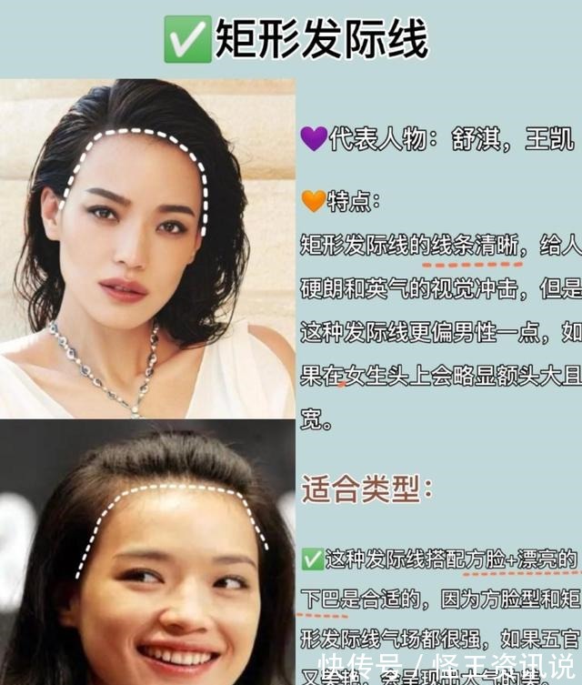 发际线 几种常见的发际线,你又是哪一种呢几分钟教你植发如何选发际线!