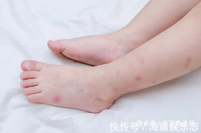 孩子|睡觉蚊子耳边叫，开了灯却找不到教你一笨招，孩子一夏天不被咬