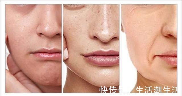 护肤 护肤品VS医美 哪个更值得!