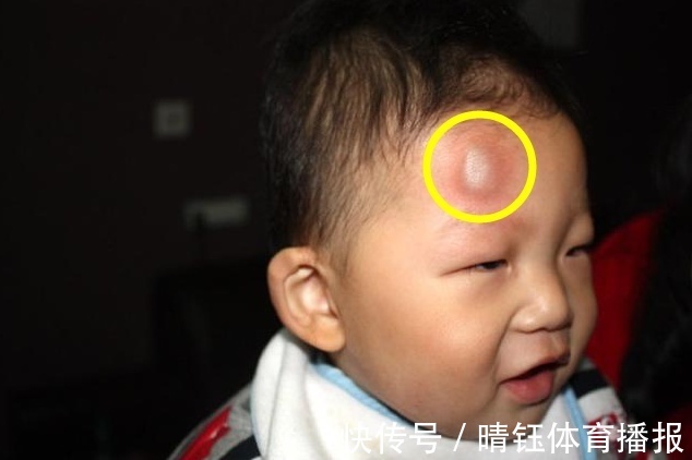 医院|12个月大的宝宝不慎坠床,奶奶下意识的做法,却让孩子伤的更重