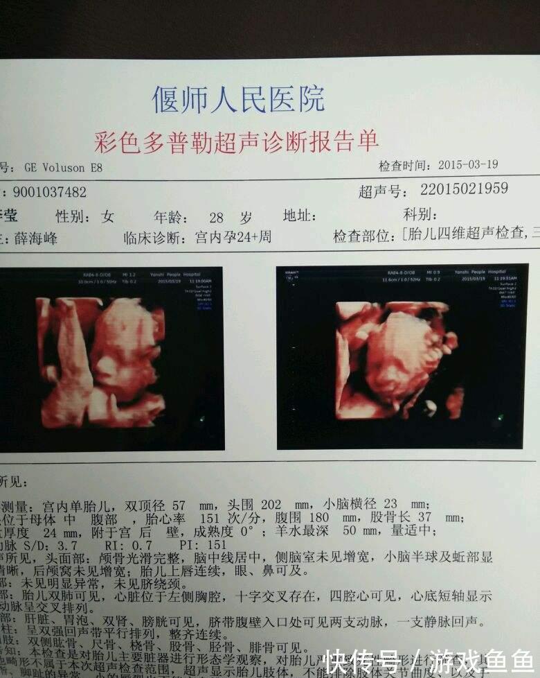 肾盂分离|四维彩超单辨男女,准不准?