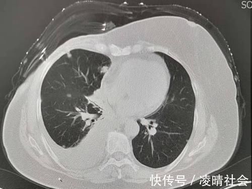 病人|对癌症病人隐瞒病情,是善意的谎言吗?对治疗有帮助吗?