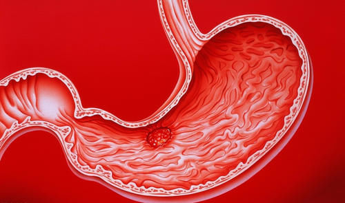  利血平|“0号”降压药，减慢心率、扩张血管、利尿降压，但要注意胃出血和抑郁