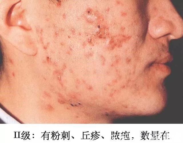 护肤品 哪些皮肤问题是护肤品不能解决的!