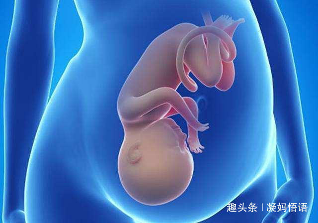 踢肚子|孕妈感觉胎儿踢肚子一般有3种情况,第三个说明宝宝在“求救”
