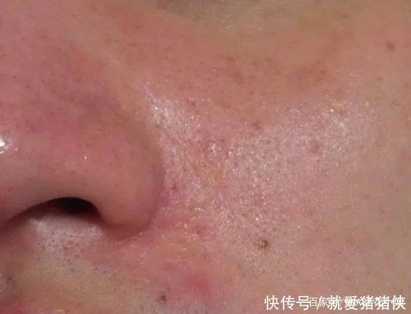 皮肤“干净”的女生，才是真的气质好看！这个护肤细节很值得学