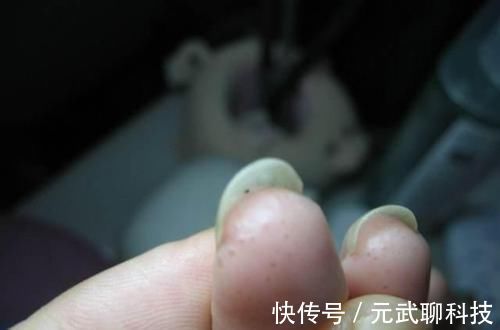 致癌物|手上长透明小水泡，还反复发作？其实不是上火，少做3件事摆脱它