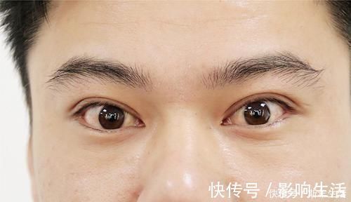 肿瘤医生|肿瘤医生:身体频繁有3个迹象,或是甲状腺癌“一级预警”