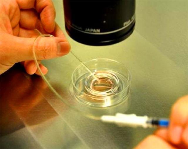 掌上明珠|我国首例“试管婴儿”郑萌珠,如今32年过去了,她生活过得好吗?