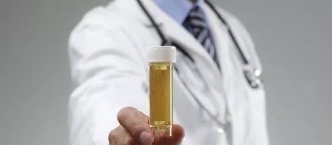 氯沙坦钾片|糖尿病人尿中有泡沫，两个+专家谈治疗方案