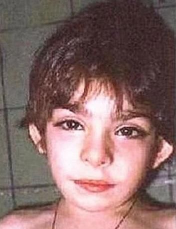 睫毛|宝宝长得太漂亮也是一种病?“歌舞伎综合征”到底是个什么鬼