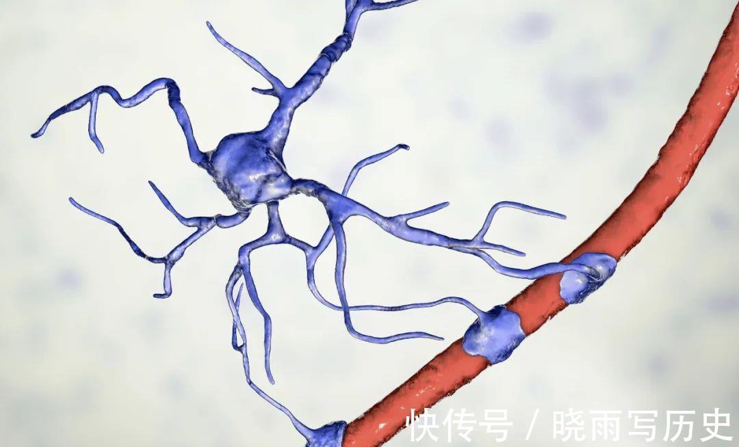 小事|血管被堵住，会给身体带来3大危害，保护血管要从这4件小事做起