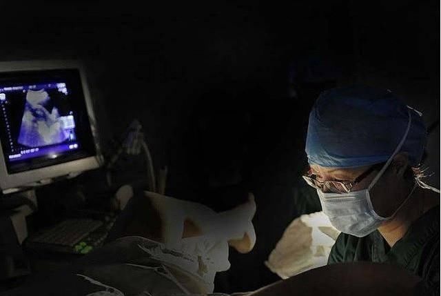 胚胎|揭秘试管婴儿全过程(附图)，看完后心疼女性一万遍