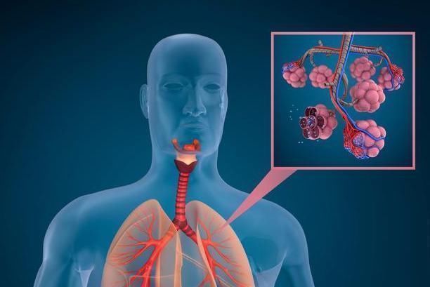 食物|肺癌多是自己“养”起的，医生忠言，这五种食物，还是少碰为好