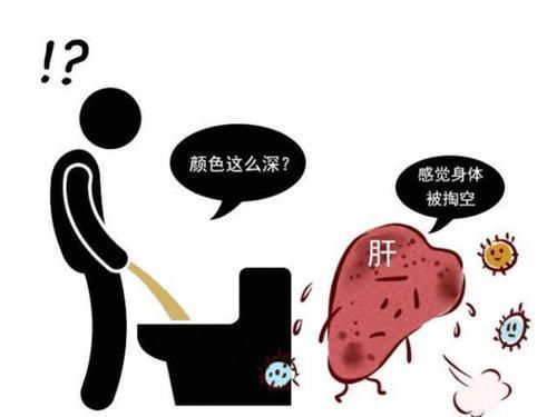 肝脏|上厕所出现4个“迹象”,赶紧检查下肝脏,肝脏疾病已经严重了