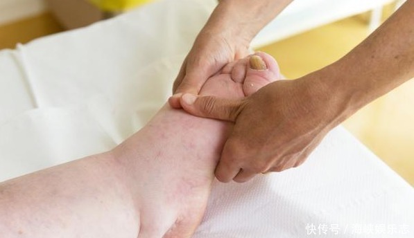 黄芪泡水不能长期服用会对身体有什么影响