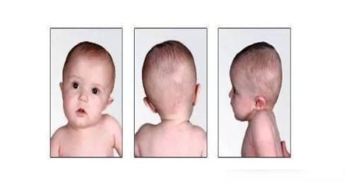 宝宝|新生儿做这个动作看上去特别可爱,但有可能是生病信号,别大意了