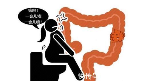 恶性肿瘤|直肠癌多半是拖出来的?4种异常迹象,暗示直肠已“亮红灯”