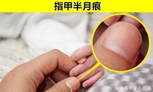 在生活中经常见到,但却无法准确说出名称的8个事物