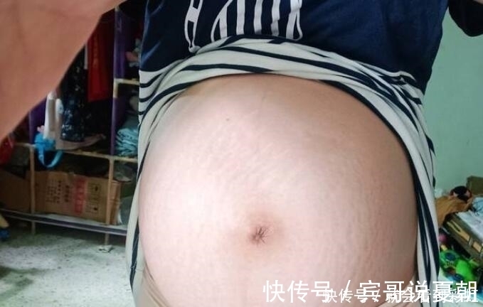 凹凸|怀孕后孕妇从这周开始显怀，如果肚脐没有这种表现，说明很有福气