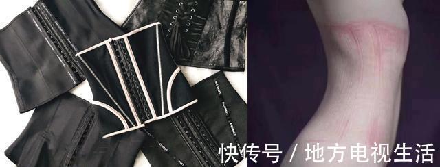 tips|产后什么时候可以穿收腹衣剖宫产和顺产的时间有不同,别记错了