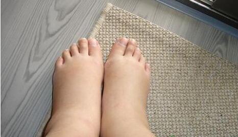 脚趾|“肾”好不好看脚，若脚上没有以下4种情况，说明你的肾很健康