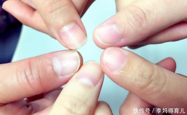 熬夜|生育能力高的女性,往往有4个明显的特征,占的越多越容易怀孕