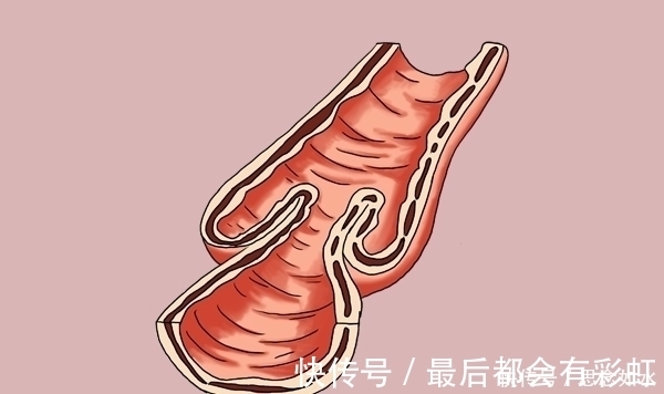 肠胃|过午不食5年,47岁男子得到了什么?他的经历,望能引起警示