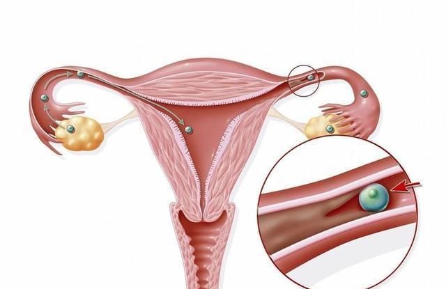 疾病|糟蹋子宫的这几种行为，现在还不改掉，当心以后疾病“找上门”