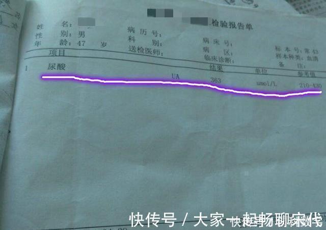 嘌呤|他喝酒50年,自称不怕痛风,秘诀只有1个,尿酸保持得好