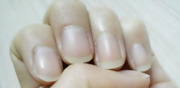 信号|肝出事手知道,手上若出现3个“信号”,或许是肝癌在敲门!