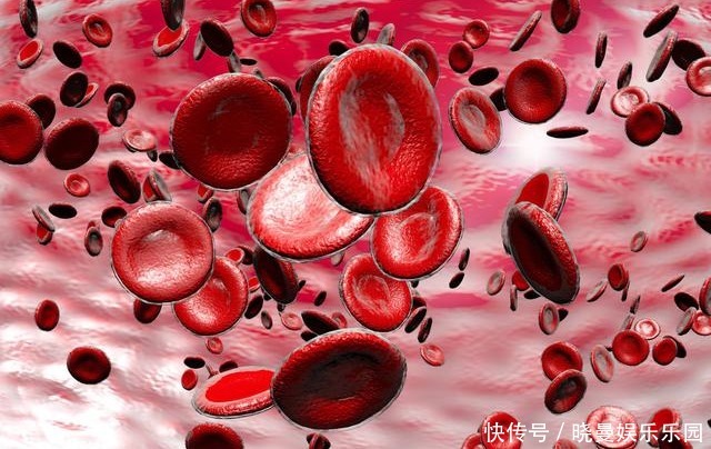 糖尿病患者|血脂高不高,看头就懂,若没有出现这3大症状,你就知足吧