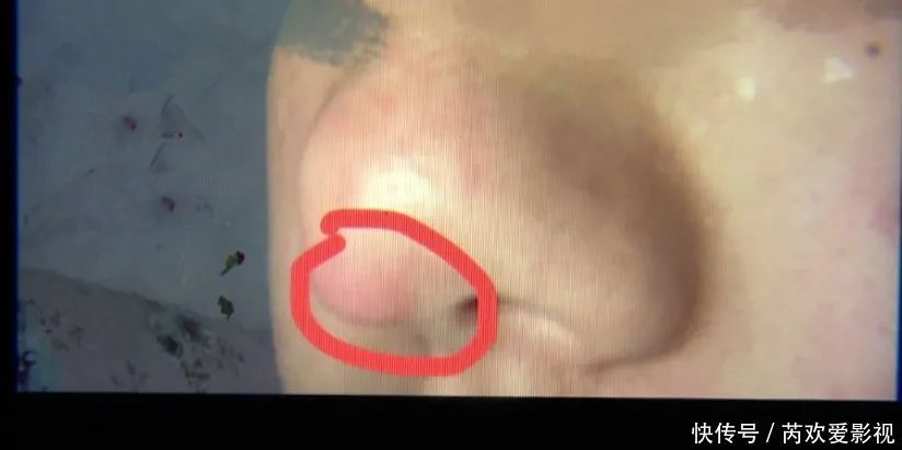 漂亮姑娘刚怀孕,鼻尖出现神秘白色物体!婆婆追问下,她瞒不住了…