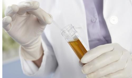 医生|女性发生尿路感染,该怎么办?医生:3个方法教您如何解决