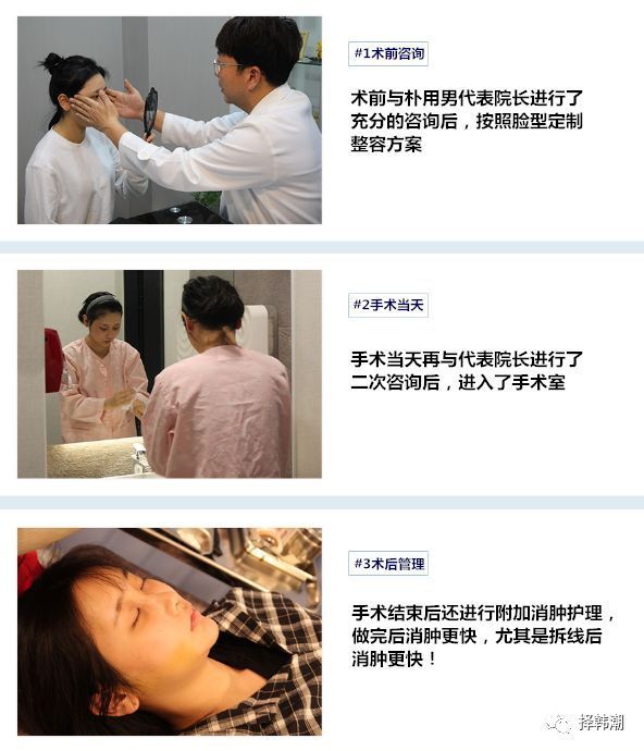 脸骨整形外科韩国人整容案例 快资讯