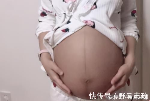 黑线|为什么孕妈肚子上有黑线?和这三个因素有关,孕妈要了解