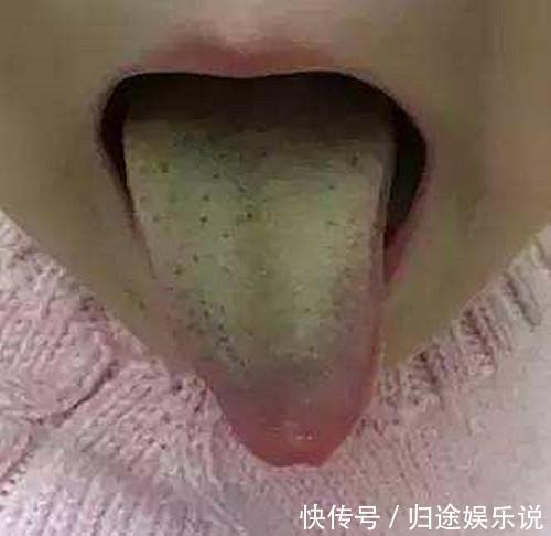 怀孕|4岁女孩肚子1米粗,像怀孕五个月,爷爷却说没事,吃的多胖点好