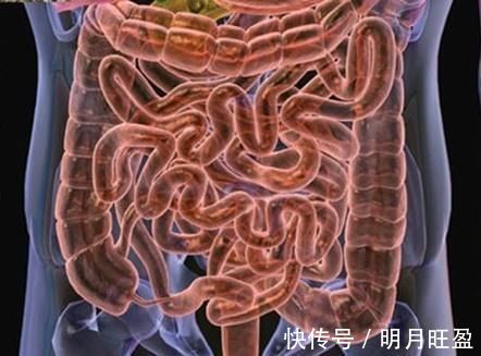 全身性|便秘是不是病,每年都关于“便秘猝死”的事发生,早知早受益