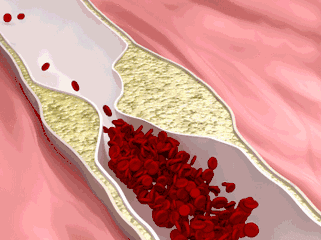 糖尿病足|过了50岁如果没有以下疾病,说明你的身体非常健康