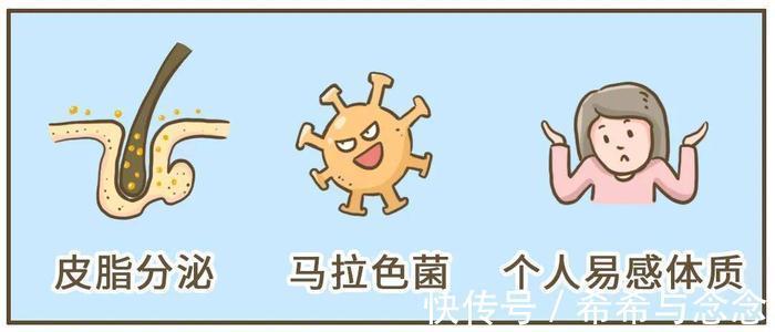 头皮|还在怀孕如何去屑的路上挣扎吗?一篇全方位“终结”你的孕期头屑